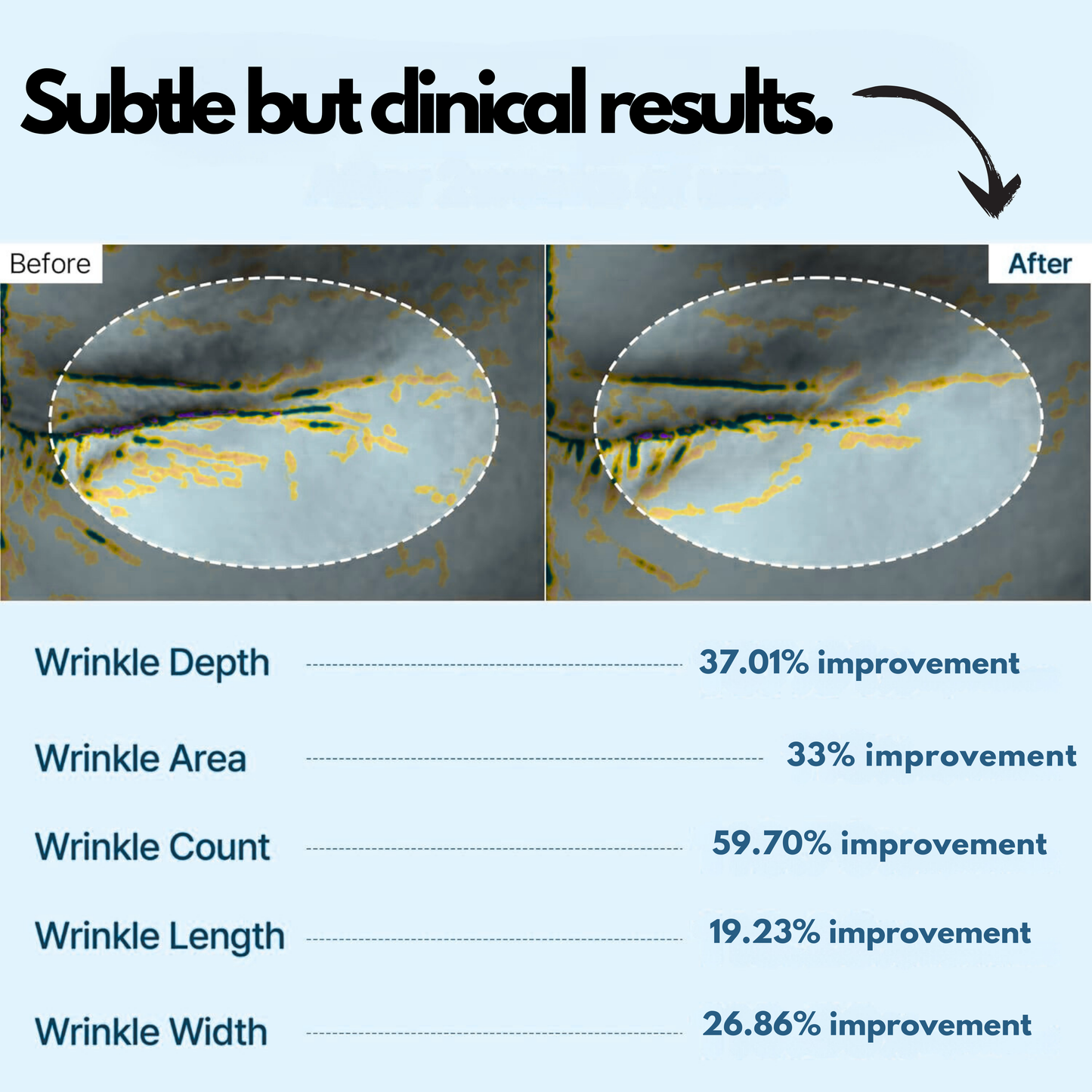 Calcium Balm - Wrinkles, Spots, Sagging, Aging